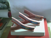 Artery Stent Angioplasty